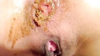 scat queen pooping through a tube and pissing