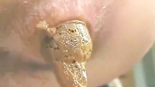 Massive turd coming out of asians butt girl pooping