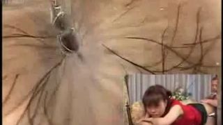 Colonoscopy with Asian girl