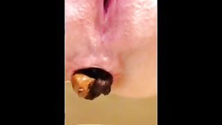 Hard turd in close up
