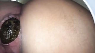 Girl let out big turd