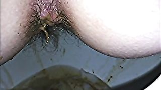 Diarheea over the toilet