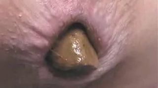 Hard turd in close up