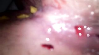 Girl on period shitting