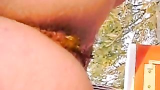 Shitting at the beach