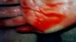 Rough Fisting Bleeding | BDSM Fetish