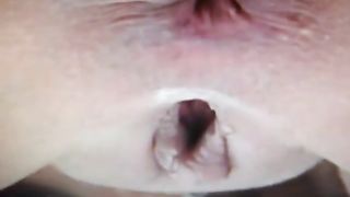 Insane close up pooping