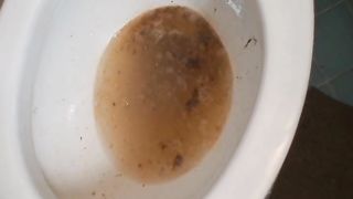 Brunette Girl Puking In the Sink