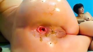 Webcam vixen fisting her asshole