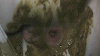 Green diarheea in brown pantyhose