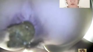 Hairy girl on hidden camera