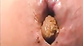 Pulled down her panties to poop