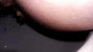 Wife has a hairy shitty ass