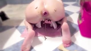 Insane anal prolapse after rough masturbation