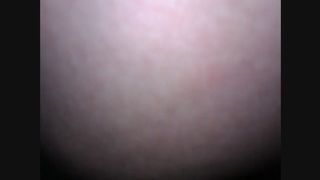 hairy wife shitting close up