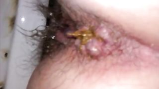 hairy wife shitting close up