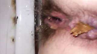 wife shitting in the toilet with hairy pussy