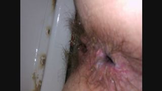 wife butt taped while shitting dirty pink butt hole