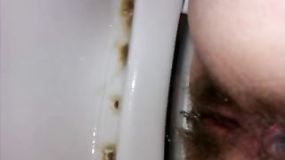 wife butt taped while shitting dirty pink butt hole