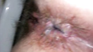 wife butt taped while shitting dirty pink butt hole