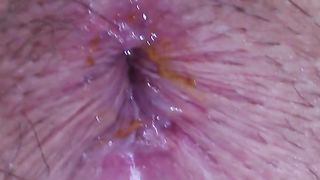 after an ass fuck a close up of her butt hole