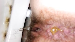 poop desperation hairy chick shits on the potty