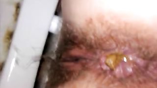 poop desperation hairy chick shits on the potty