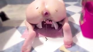 Anal prolapse after pooping and masturbating