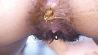 Hairy girl shitting in close up