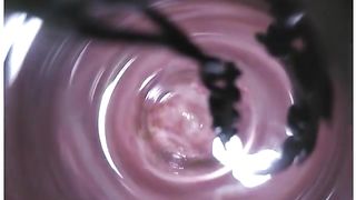 Shitty anus investigation