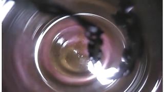 Shitty anus investigation