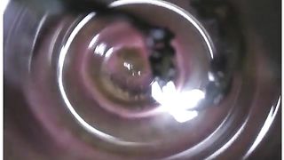 Shitty anus investigation