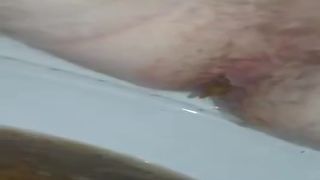 Diarheea with pressure