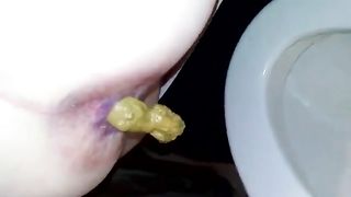 Yellow shit in toilet