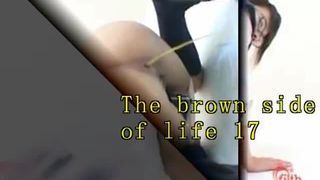 Waiting for enema at work