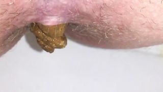 Shaved wife shitting in close up