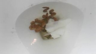 Shitting a lot in toilet