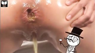 Anal sex is never so hot