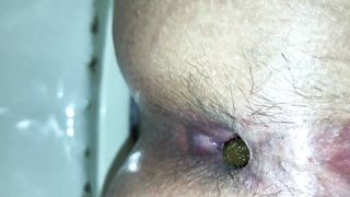 Up close - hot girl pooping 1
