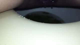 Shaved babe that has diarheea