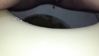 Shaved babe that has diarheea