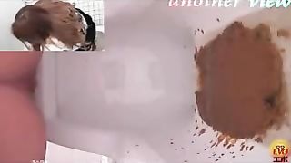 Japanese toilet diarheea