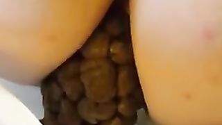 Hard turd coming out