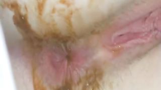 Real mess between butt cheeks