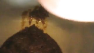 Diarheea in a homemade toilet