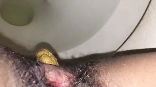 Yellow turd from a hairy butthole