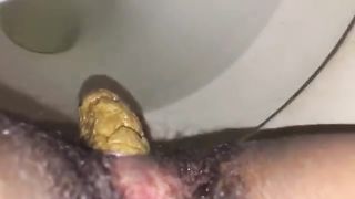 Yellow turd from a hairy butthole