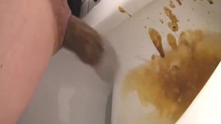 18 year old girls having diarheea