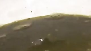 Shaved girl with heavy diarheea