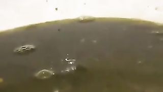 Shaved girl with heavy diarheea